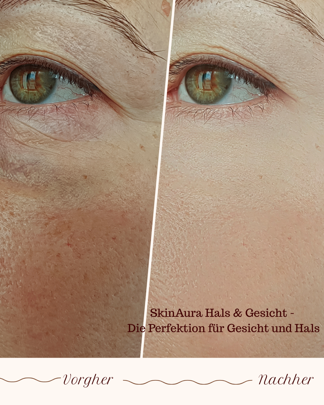 SkinAura Hals & Gesicht - Die Perfektion für Gesicht und Hals
