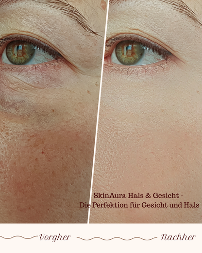 SkinAura Hals & Gesicht - Die Perfektion für Gesicht und Hals